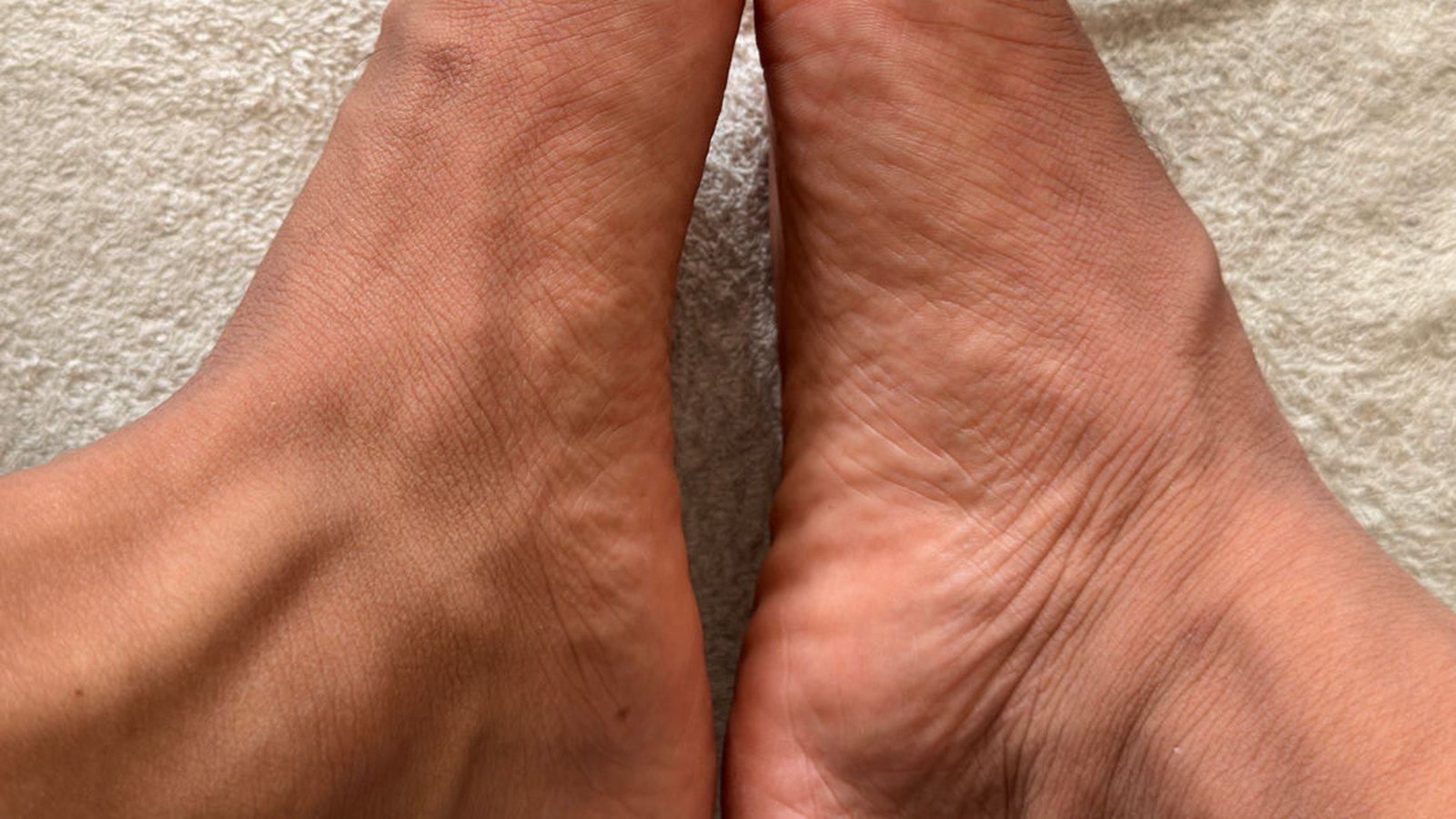 Real feet after the shed, unretouched